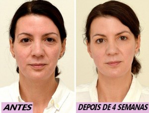 ANTES_DEPOIS