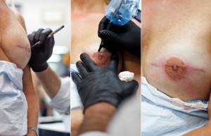 Tatuador reconstrói bico do peito:  o passo-a-passo da tatuagem de reconstrução de mamilo do tatuador Vinnie Myers: ele mede a proporção do seio e faz a tatuagem com detalhes realistas. O resultado é um "retrato de auréola". Foto: Roc Morin/Divulgação